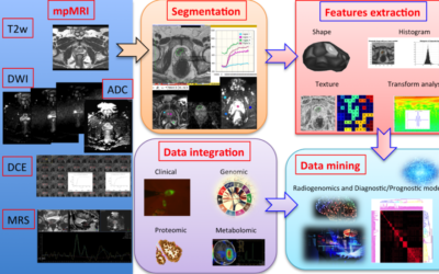 AI: Radiomic analysis in oncology